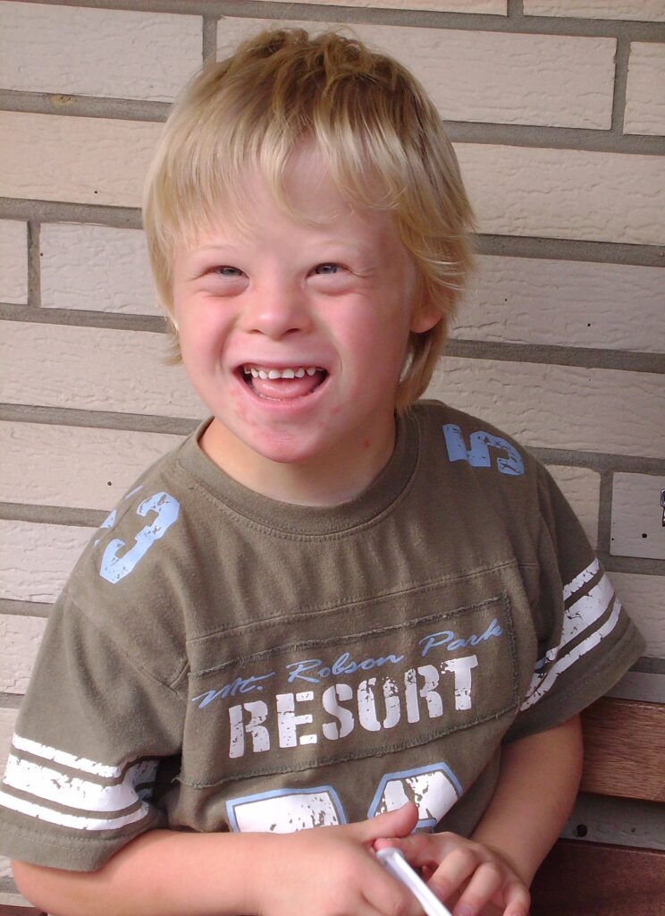 New Gene-Editing Method Successfully Removes Extra Chromosome in Down Syndrome Cells